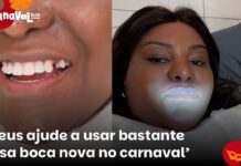 Veja Vídeo – Ex-Rouge quebra dente comendo bacalhau e corre para consertar; veja