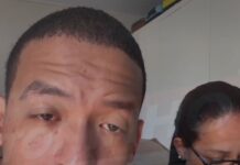 Vídeo: Cantor Léuo sofre assalto e desabafa nas redes após moto ser levada