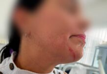 Servidora é agredida por paciente em unidade de saúde