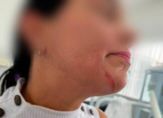 Servidora é agredida por paciente em unidade de saúde