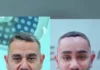 Veja Vídeo – Turco de 58 anos viraliza após passar por procedimento de rejuvenescimento no Vietnã