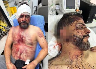 Vereador torturado durante roubo volta à UPA após piora nas dores